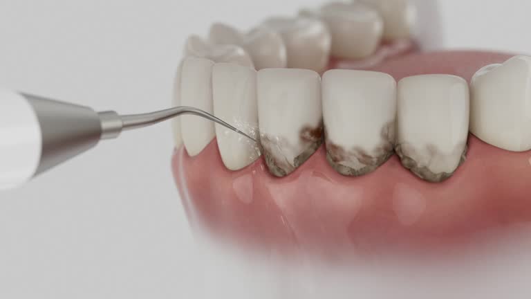 Trusted Dental Crowns And Bridges service in Stevensville, MI - Dentist Open Now
